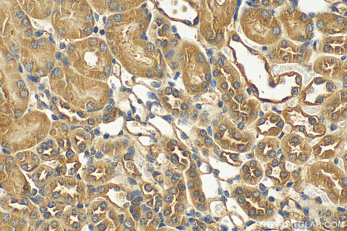 IHC staining of mouse kidney using 13009-1-AP