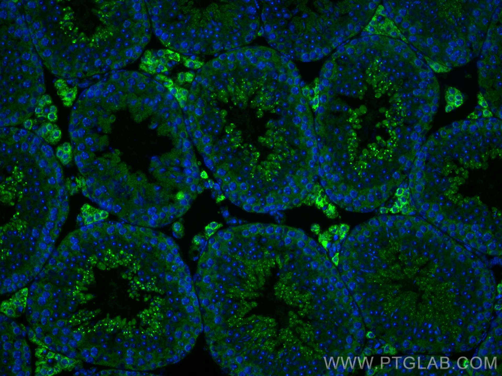 IF Staining of mouse testis using 12225-1-AP