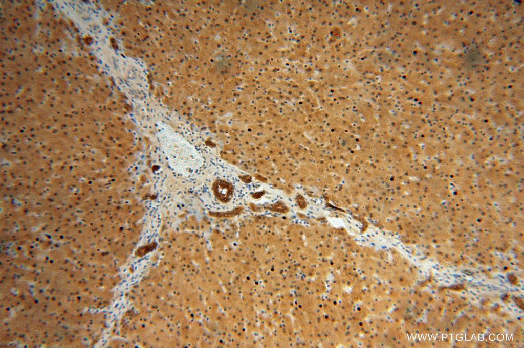 IHC staining of human liver using 17048-1-AP