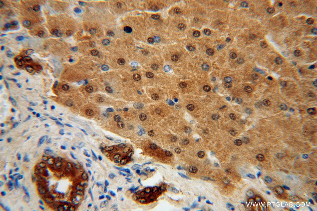 IHC staining of human liver using 17048-1-AP