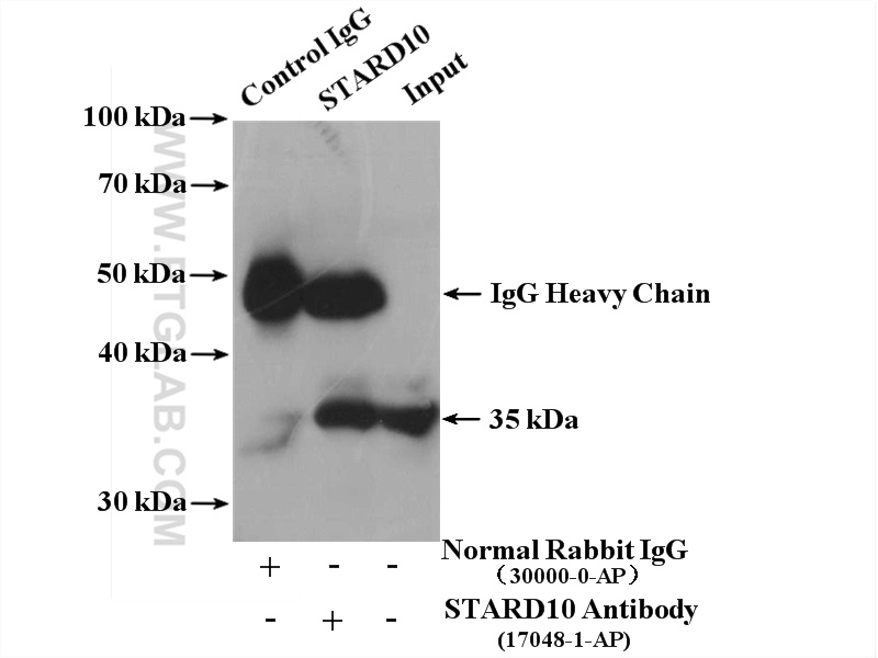 IP experiment of HepG2 using 17048-1-AP