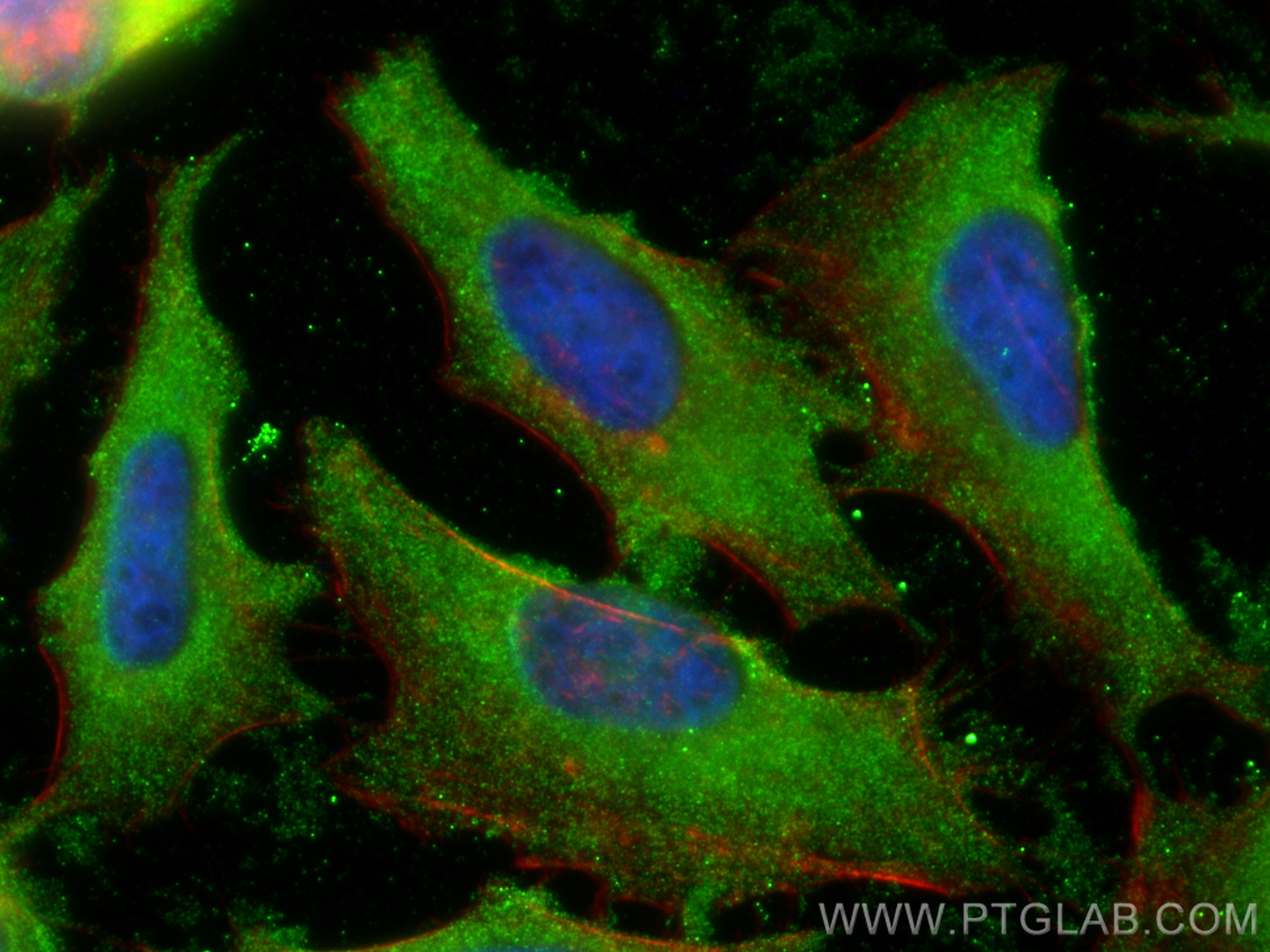 IF Staining of HeLa using 68554-1-Ig (same clone as 68554-1-PBS)