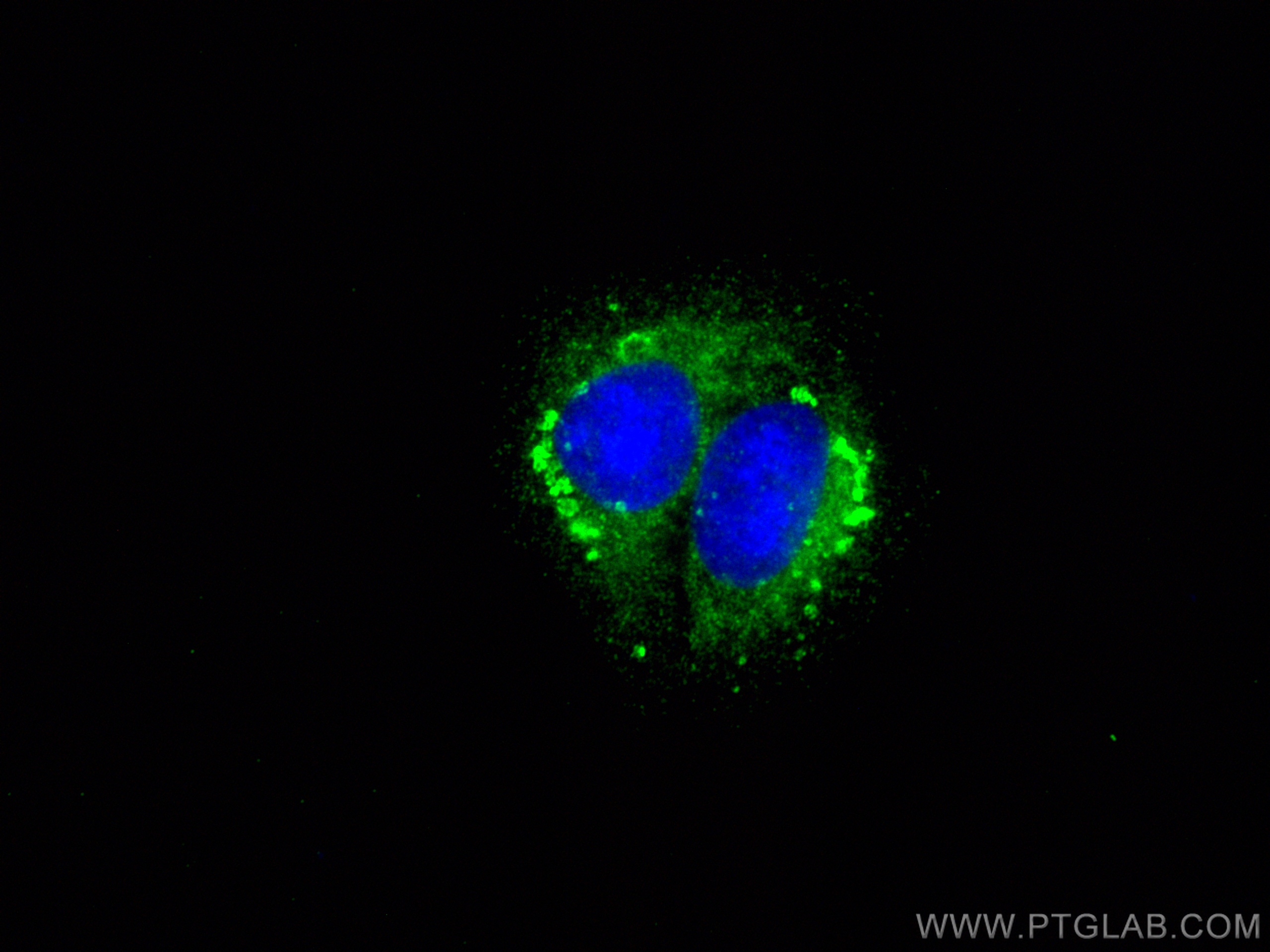 IF Staining of U2OS using 20502-1-AP