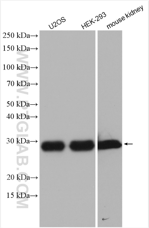 WB analysis using 20502-1-AP