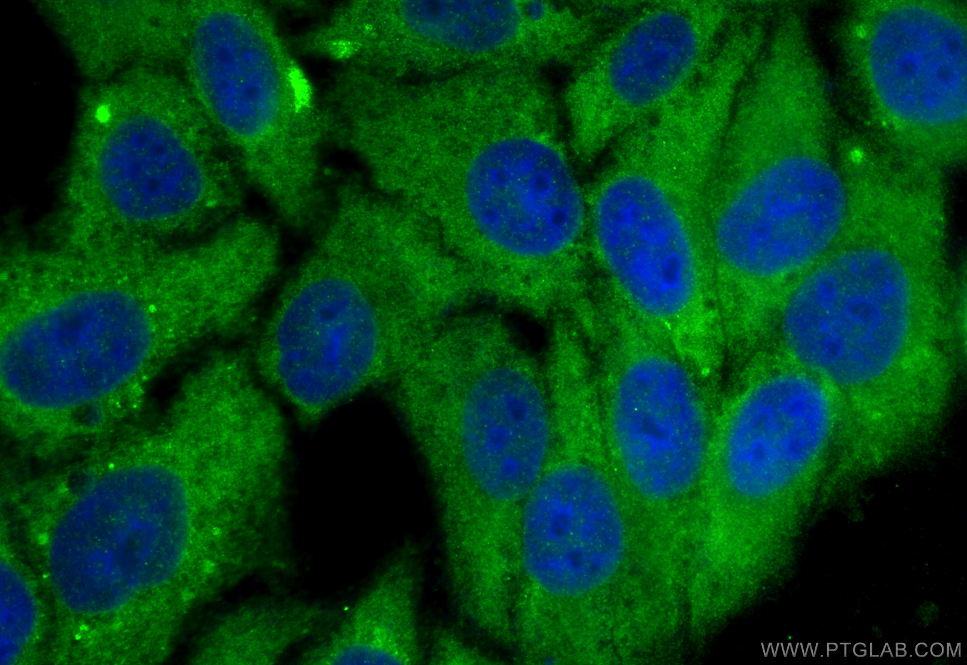 IF Staining of HepG2 using 10487-1-AP