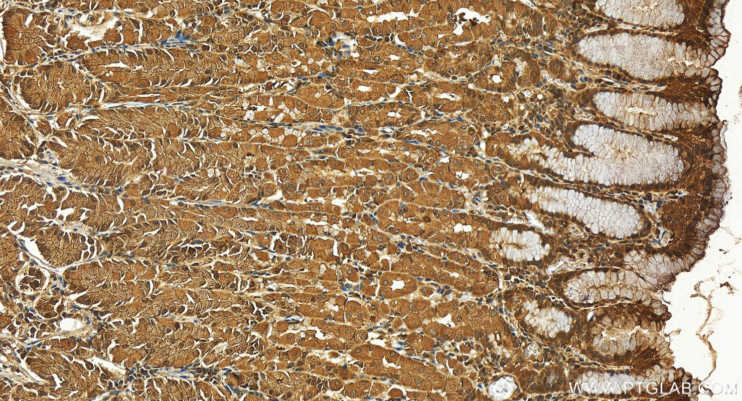 IHC staining of human stomach using 10144-2-AP