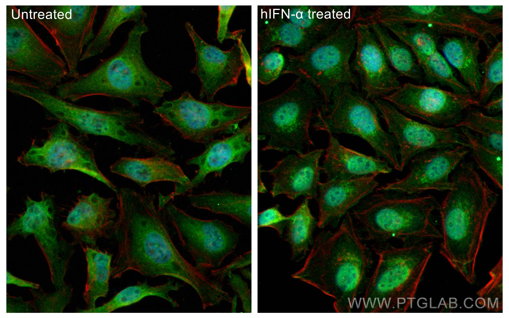 IF Staining of HeLa using 10144-2-AP