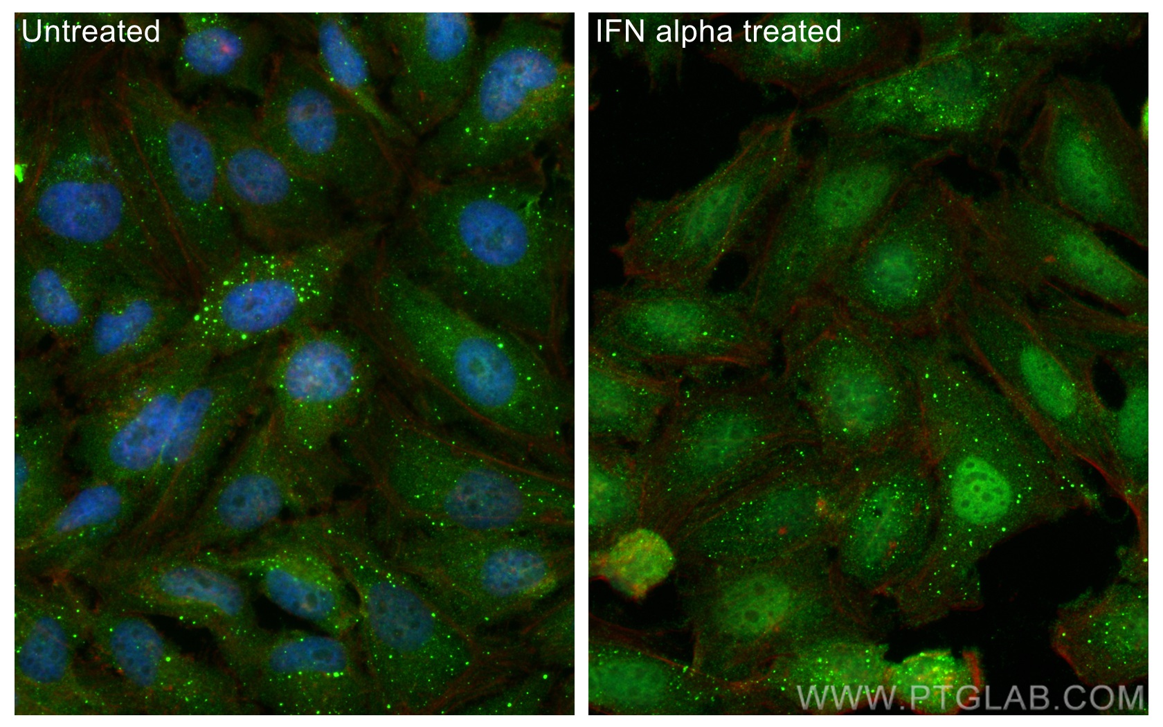 IF Staining of HeLa using 66545-1-Ig