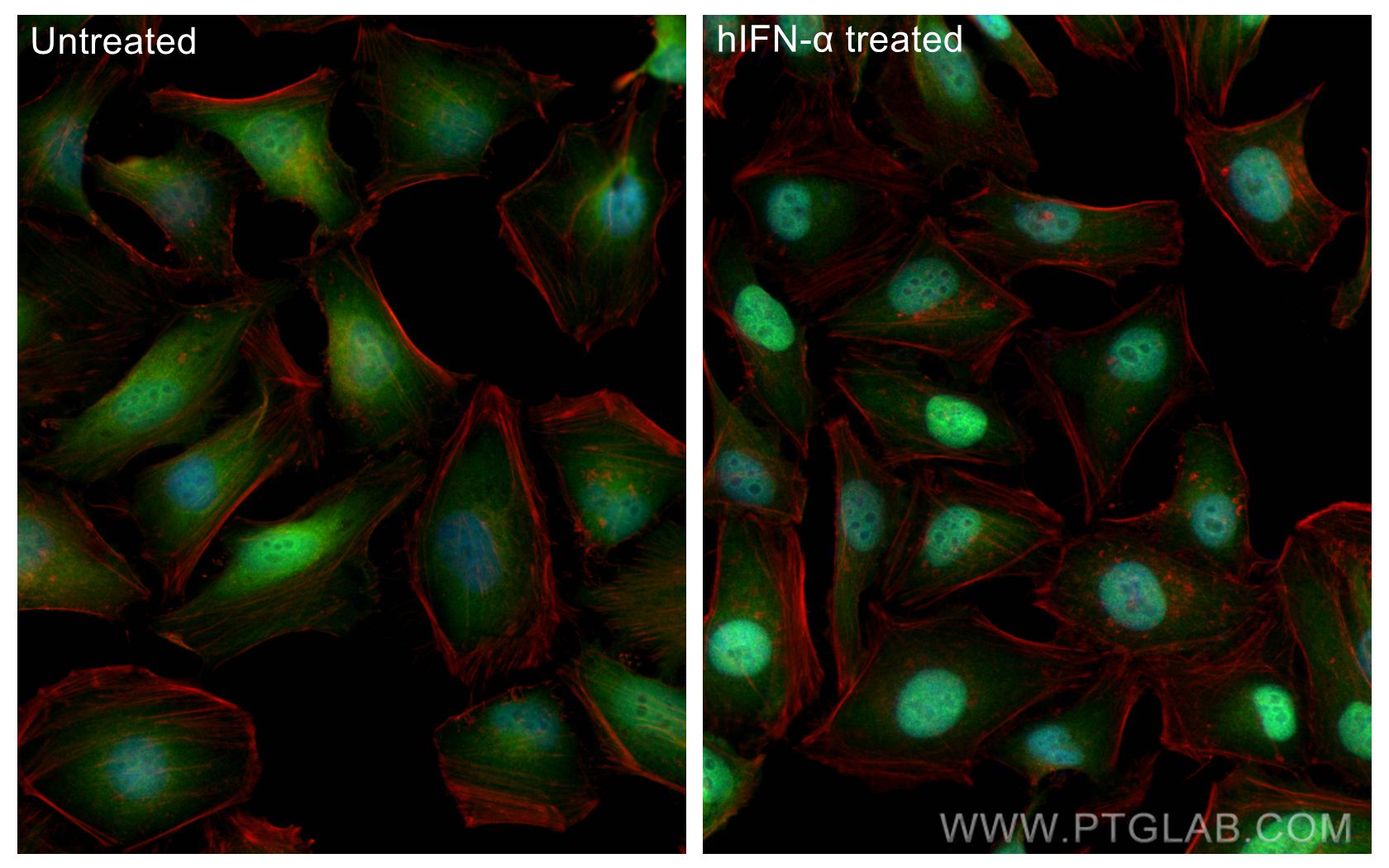 IF Staining of HeLa using 82016-1-RR (same clone as 82016-1-PBS)