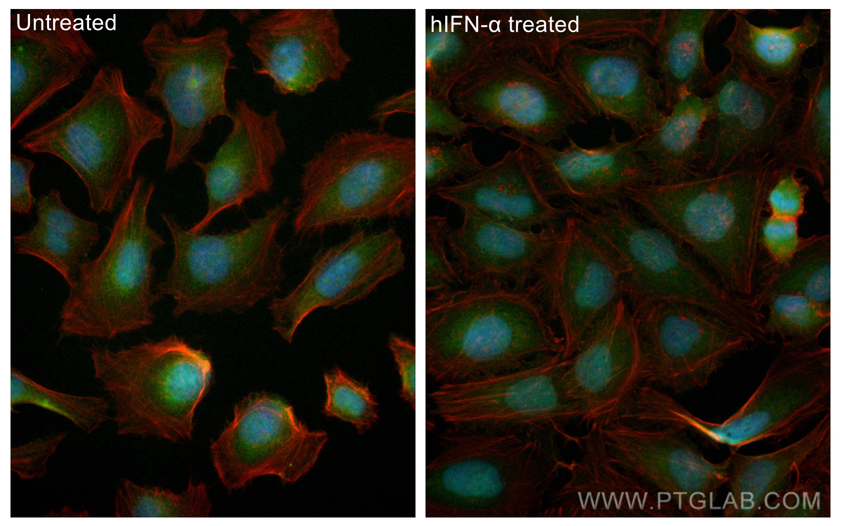 IF Staining of HeLa using CL488-10144