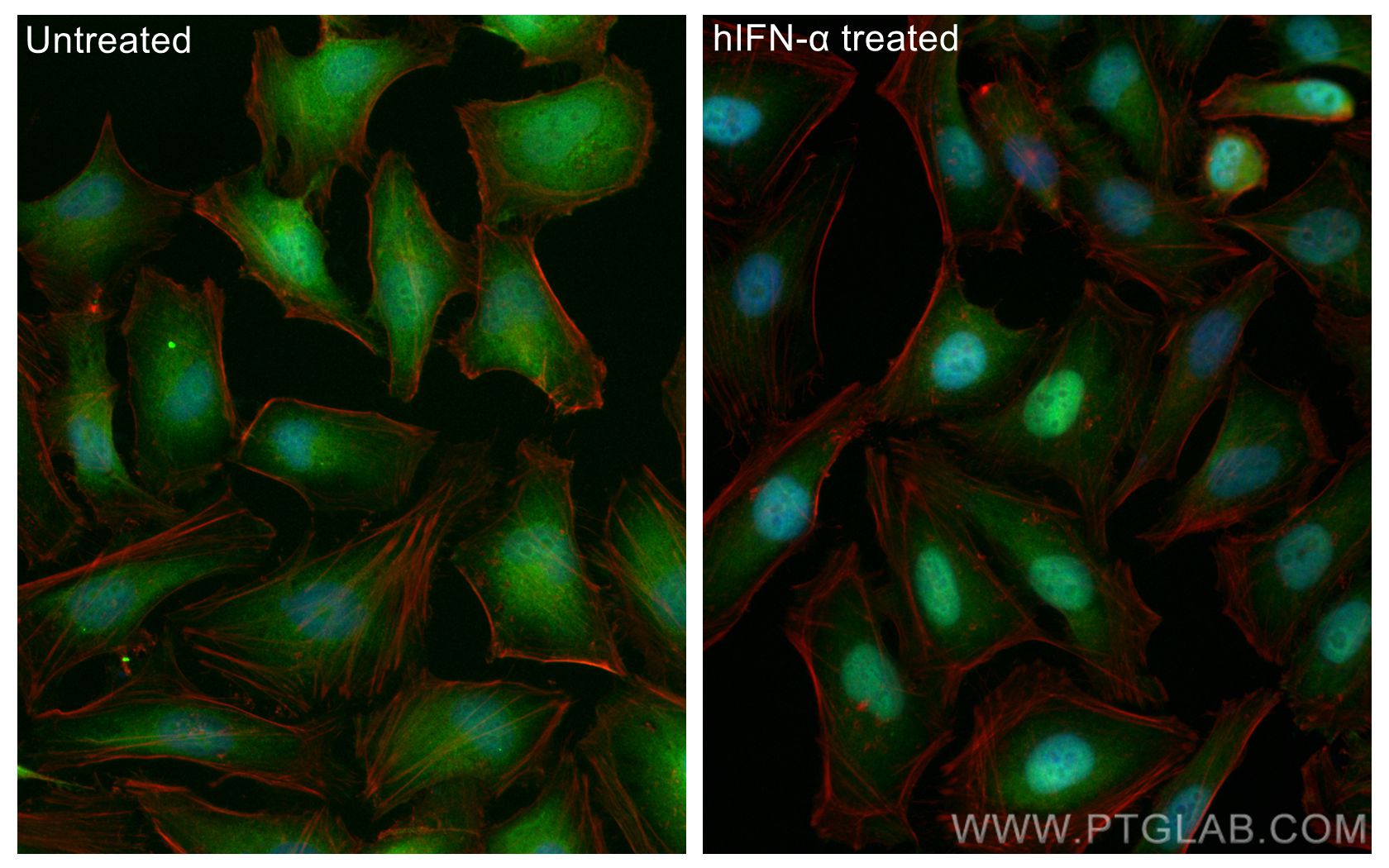 IF Staining of HeLa using CL488-82016