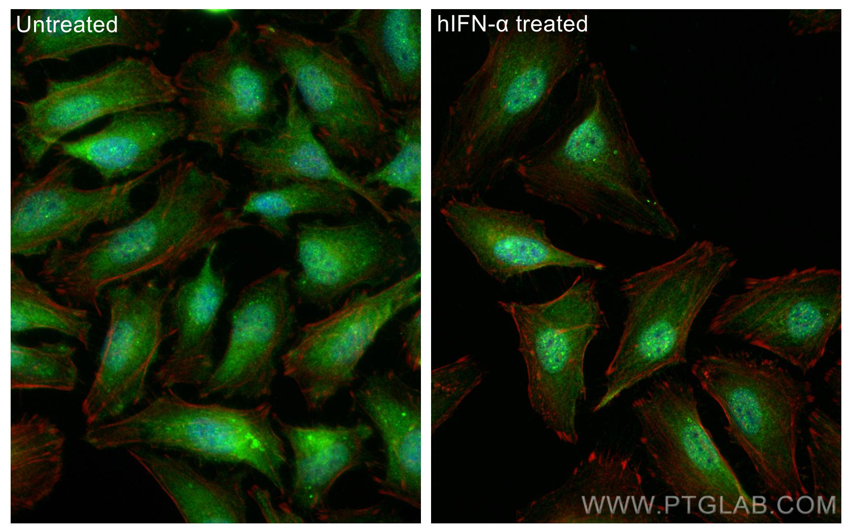 IF Staining of HeLa using 10253-2-AP