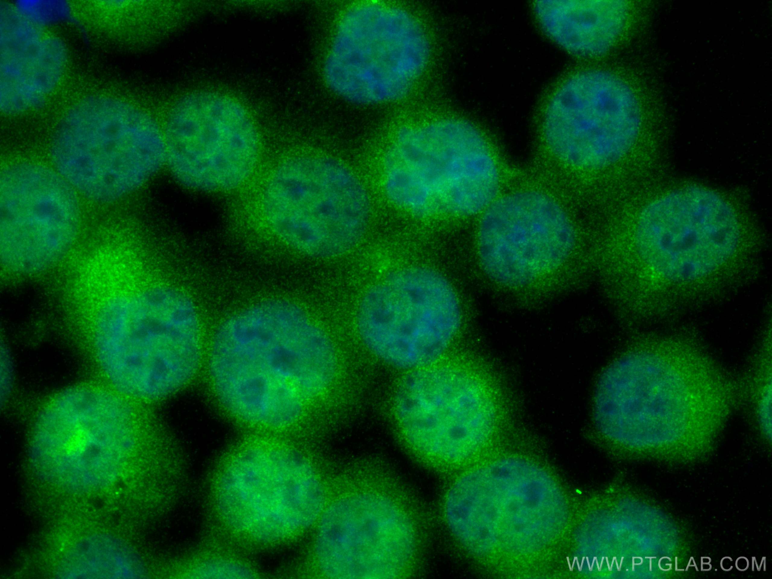 IF Staining of K-562 using 12071-1-AP