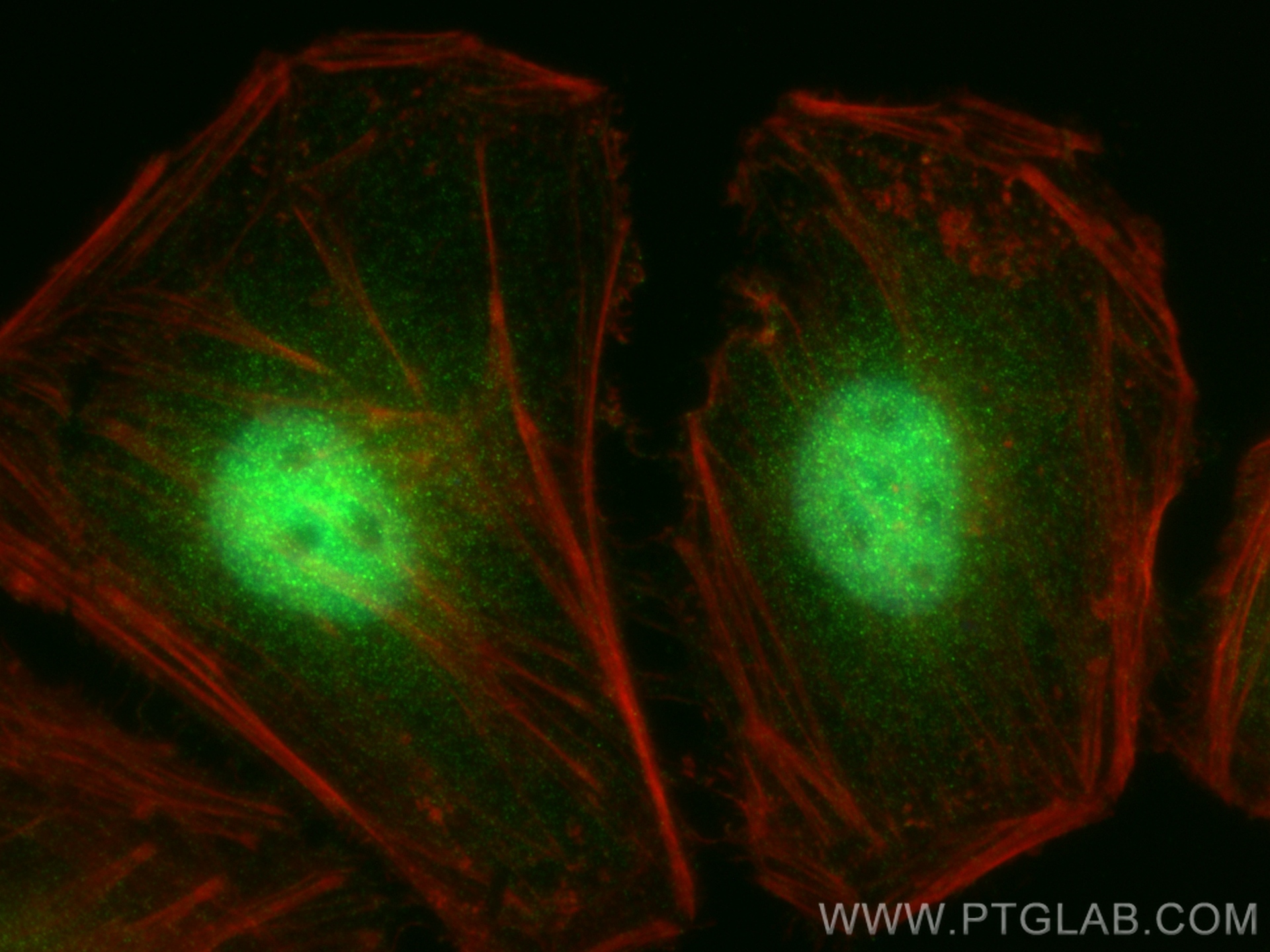 IF Staining of HeLa using 66427-1-Ig (same clone as 66427-1-PBS)