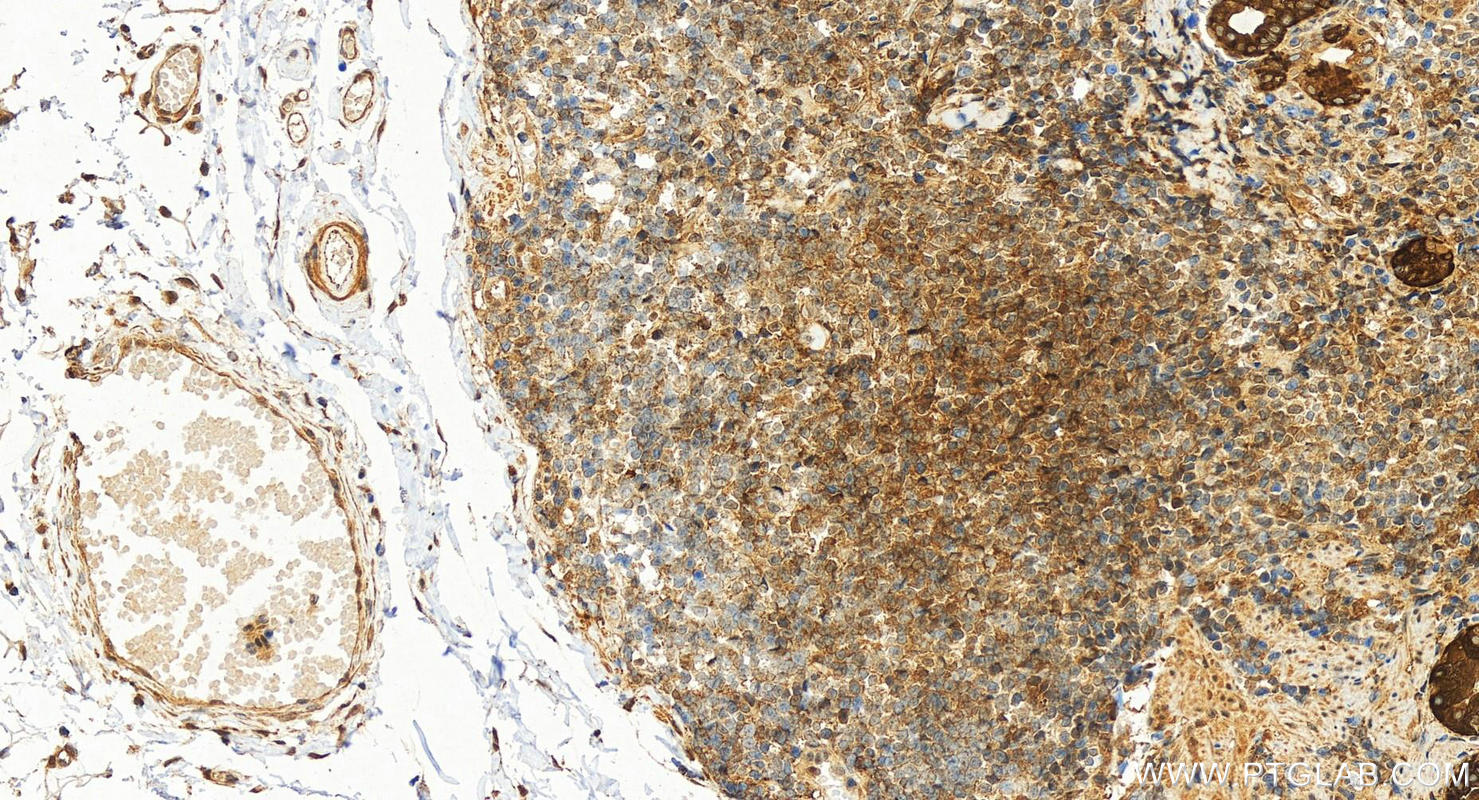 IHC staining of human stomach using 82630-1-RR (same clone as 82630-1-PBS)