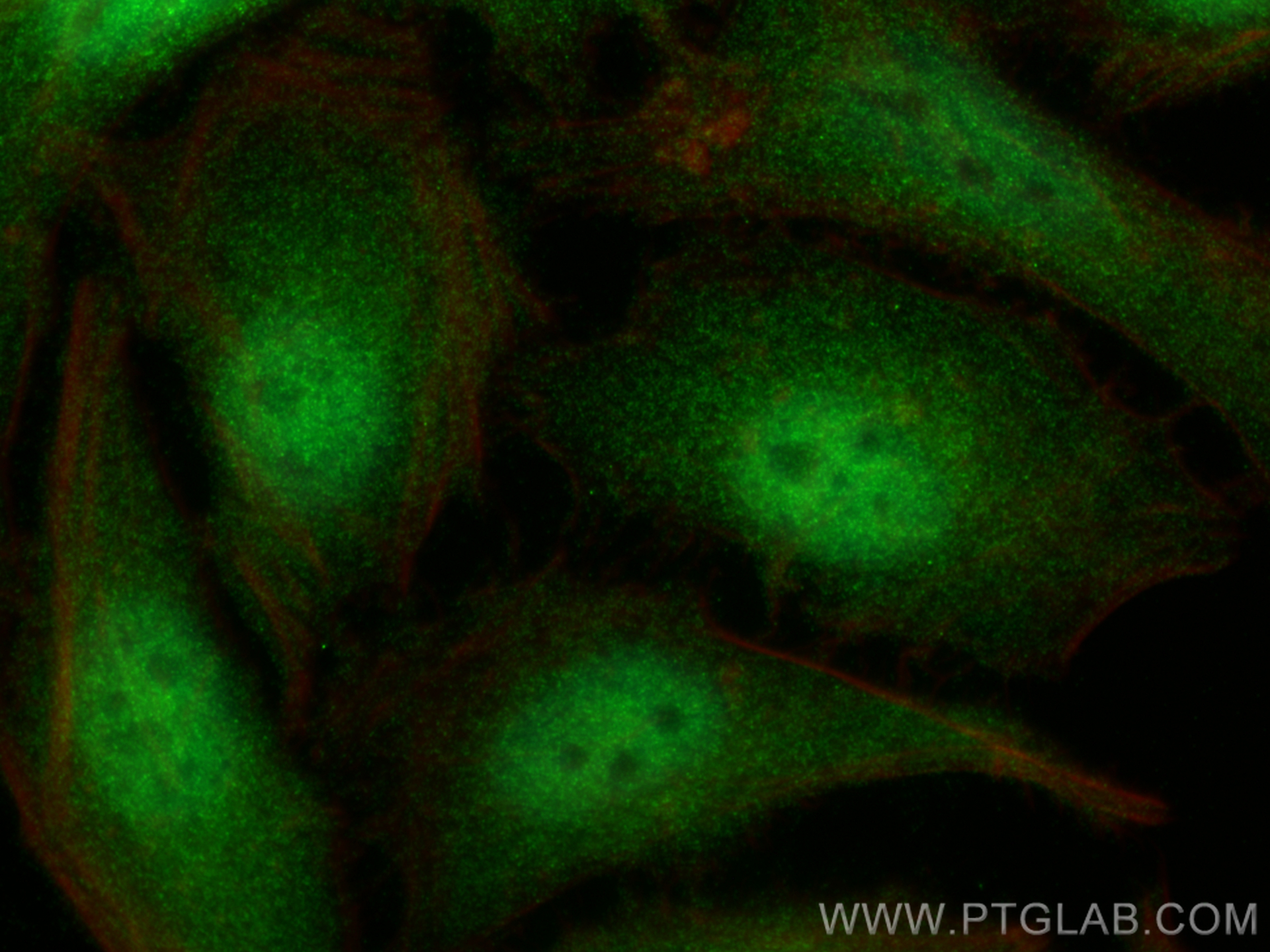 IF Staining of HeLa using 82630-1-RR