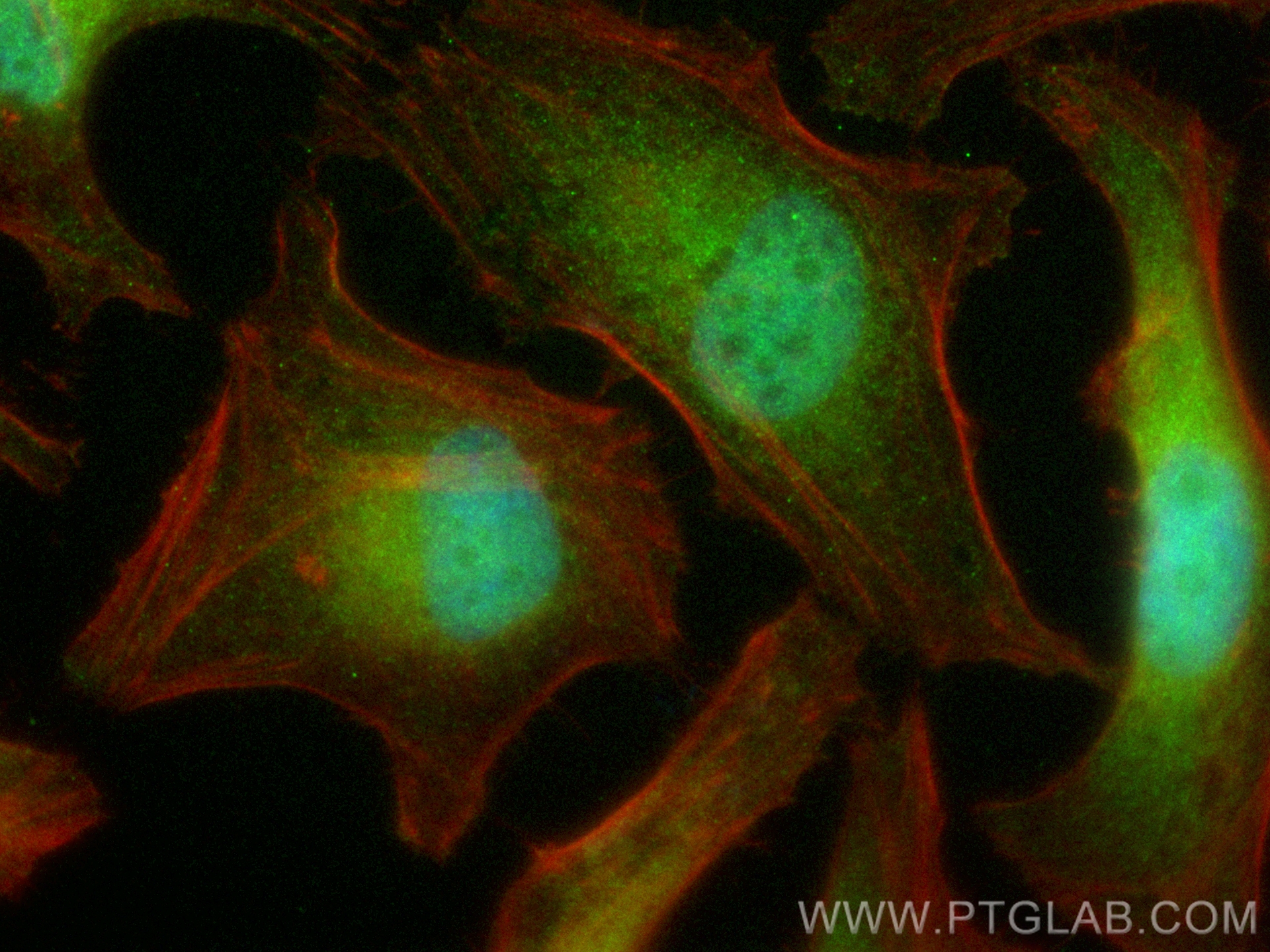 IF Staining of HeLa using CL488-82630