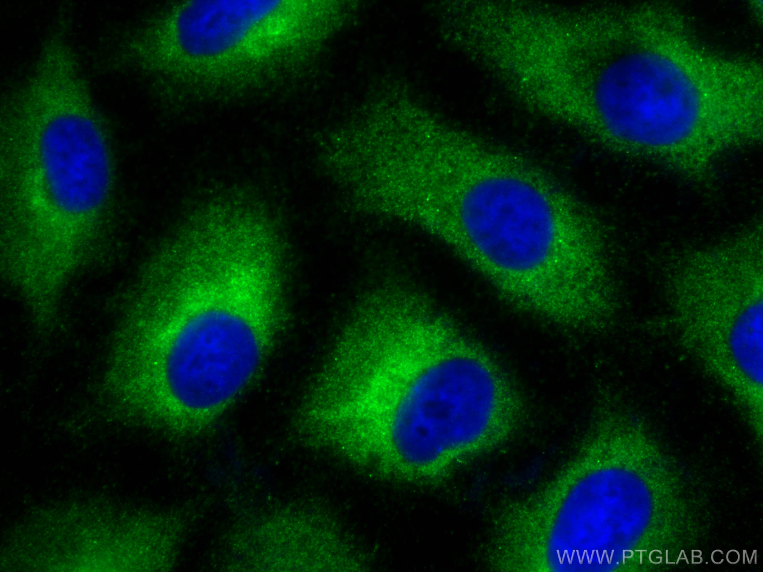 IF Staining of A549 using 14225-1-AP