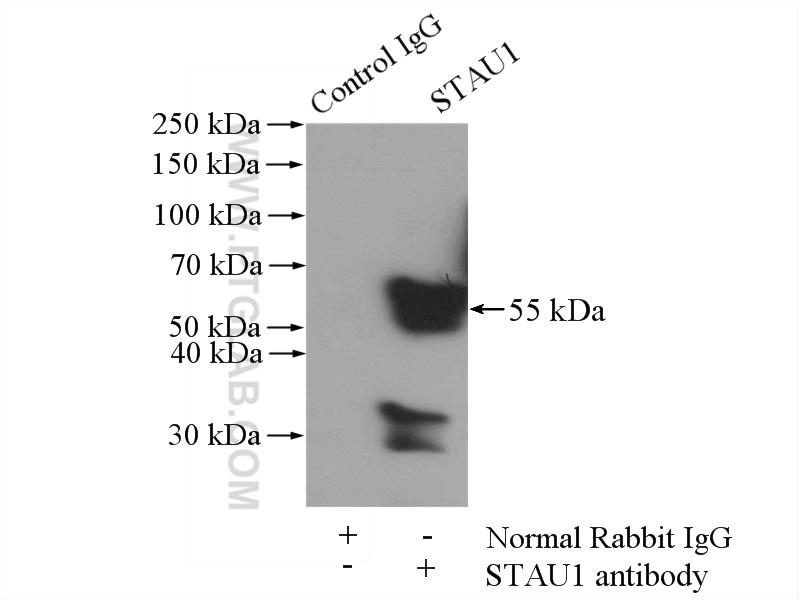 IP experiment of mouse brain using 14225-1-AP