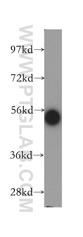 WB analysis of human brain using 14225-1-AP