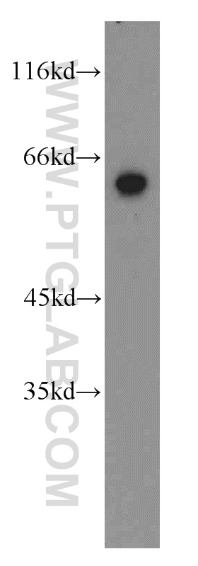 WB analysis of mouse heart using 15998-1-AP