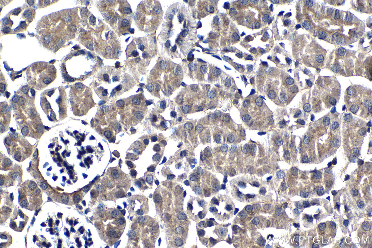 IHC staining of mouse kidney using 60063-1-Ig (same clone as 60063-1-PBS)