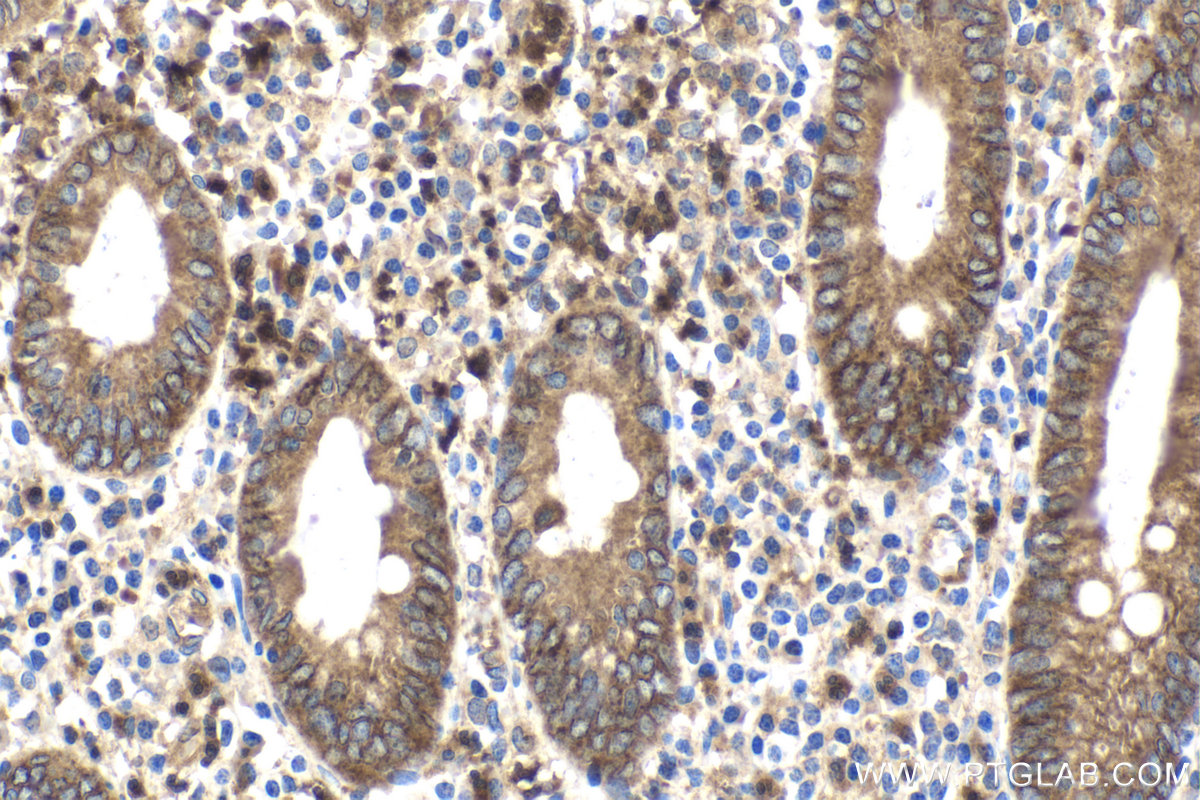 IHC staining of human appendicitis using 28478-1-AP