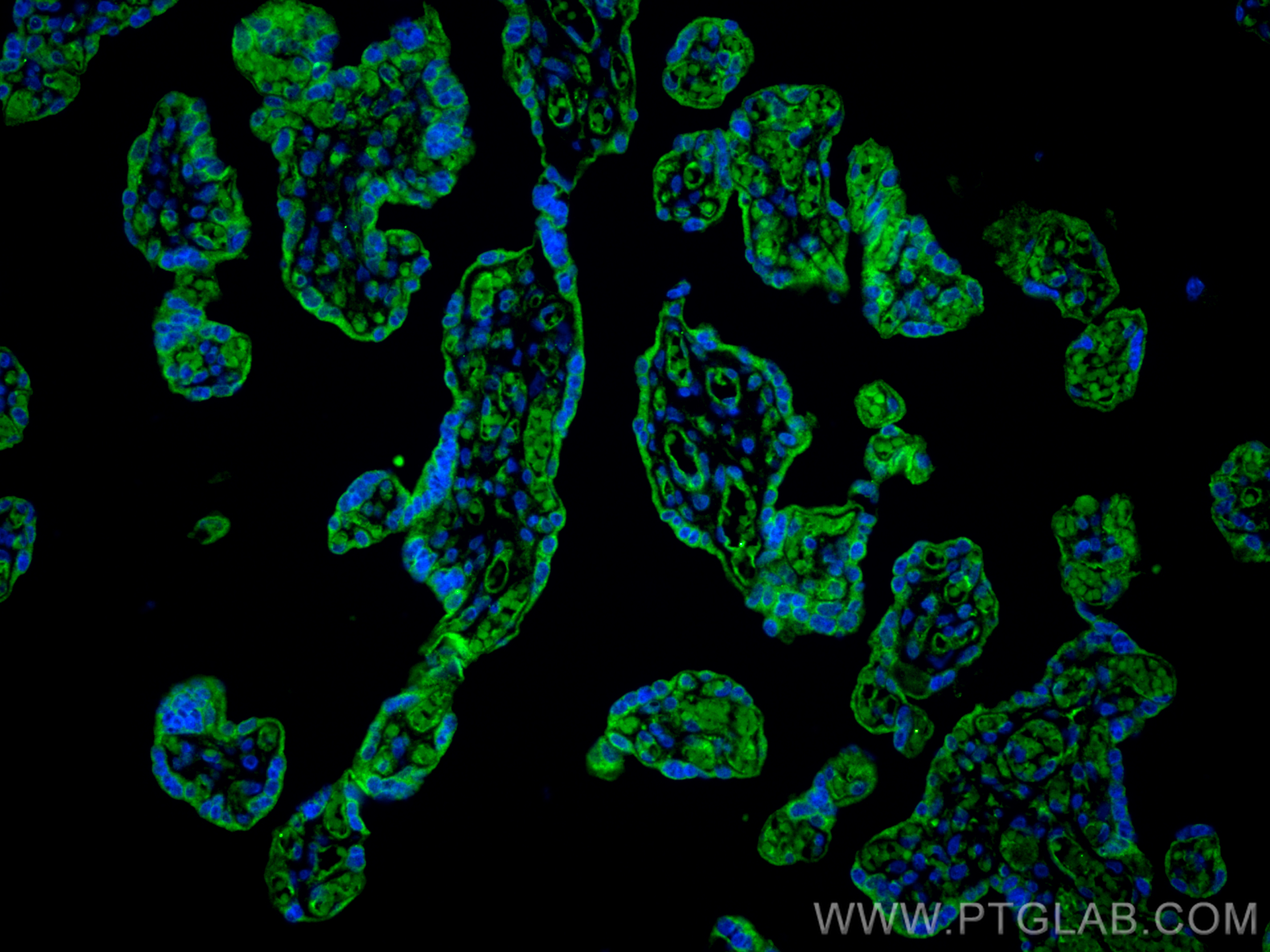 IF Staining of human placenta using 11944-1-AP