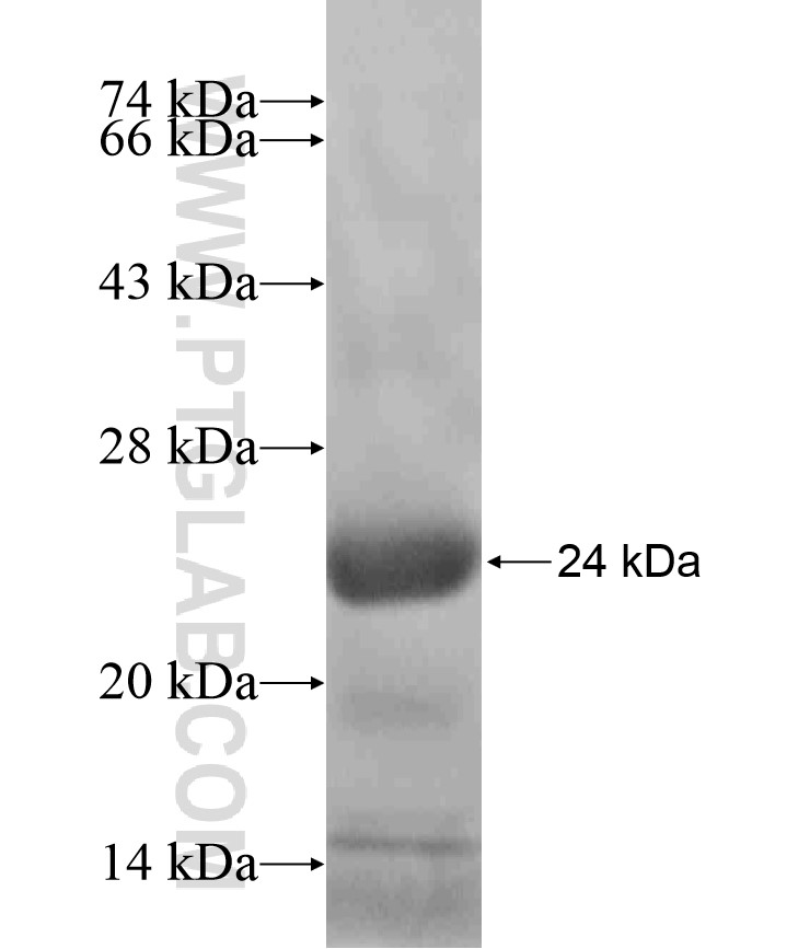 STELLAR fusion protein Ag18473 SDS-PAGE