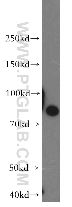 STIM1 Polyclonal antibody