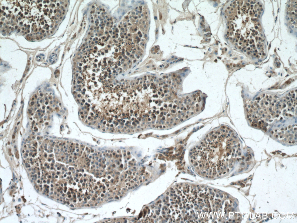 IHC staining of human testis using 66719-1-Ig