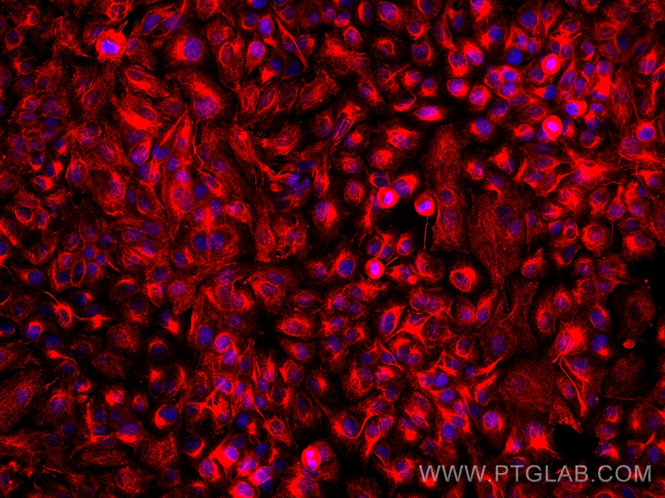 IF Staining of SKOV-3 using 68016-1-Ig (same clone as 68016-1-PBS)