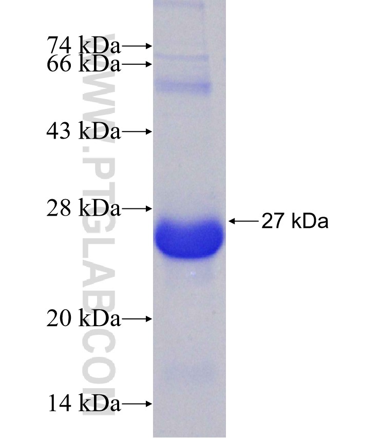 STK11 fusion protein Ag30915 SDS-PAGE