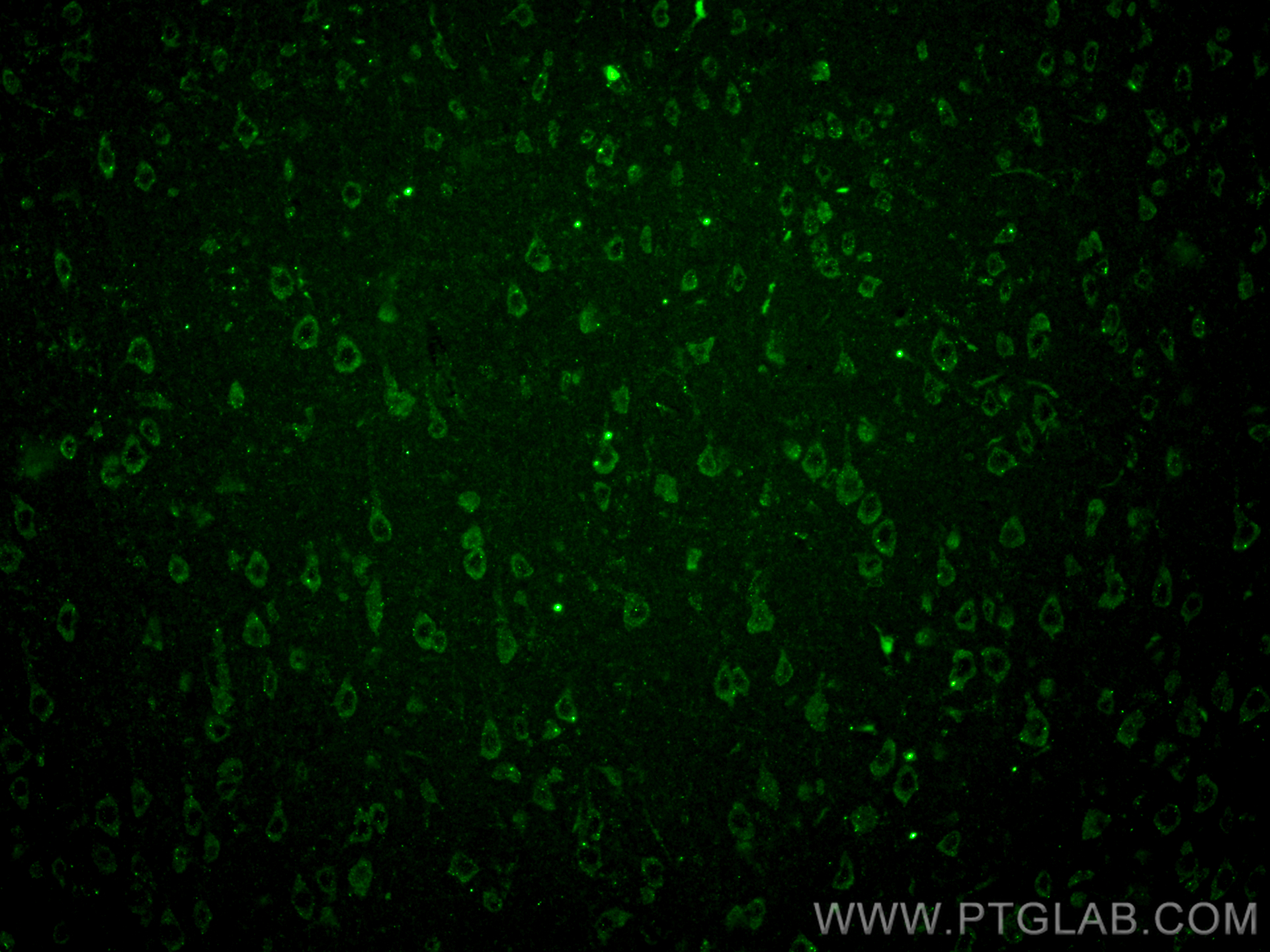 IF Staining of rat brain using 68522-1-Ig