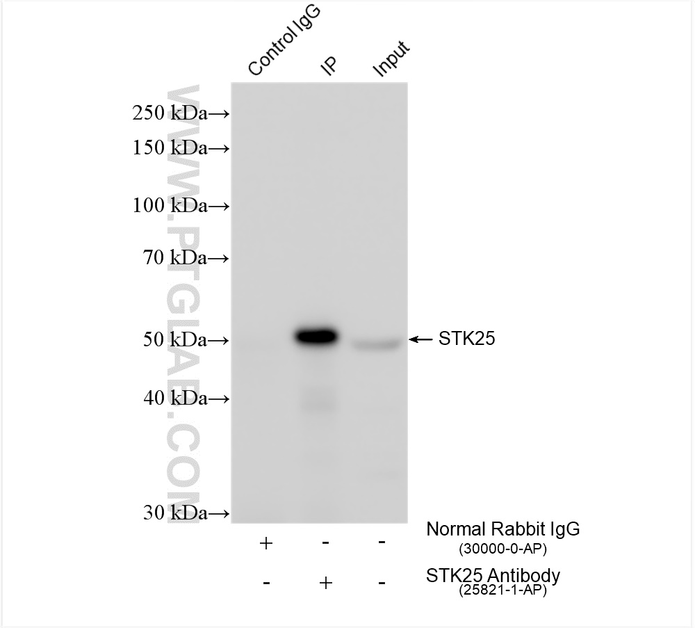 IP experiment of mouse brain using 25821-1-AP