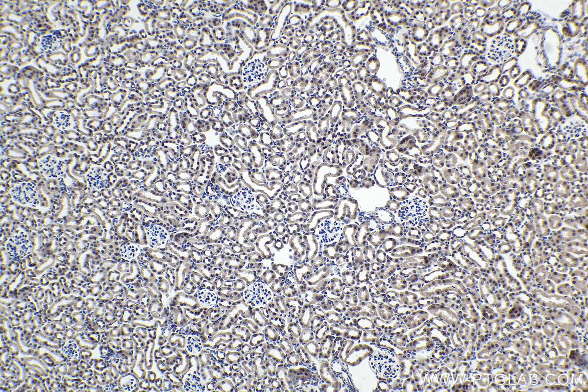 IHC staining of mouse kidney using 66637-1-Ig