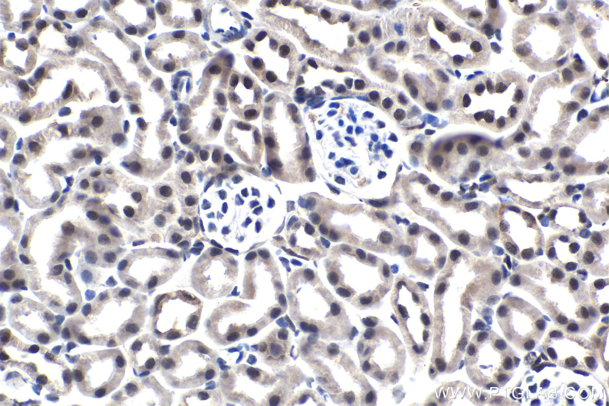 IHC staining of mouse kidney using 66637-1-Ig