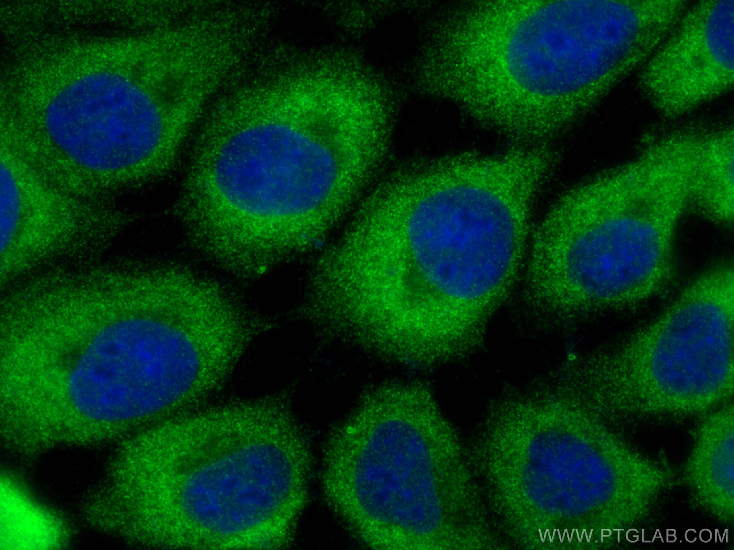 IF Staining of A431 using 12857-1-AP