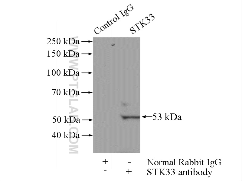 IP experiment of HEK-293 using 12857-1-AP