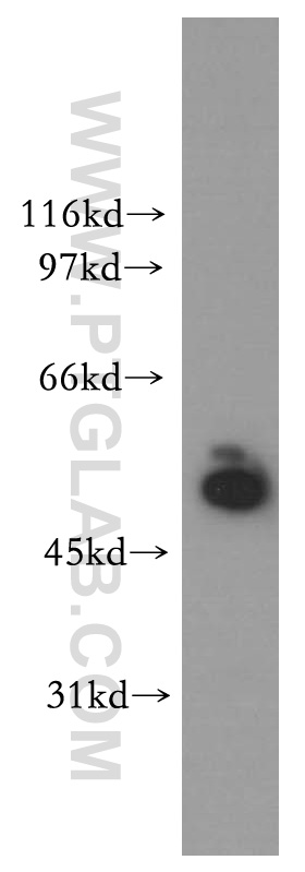 WB analysis of human kidney using 12857-1-AP