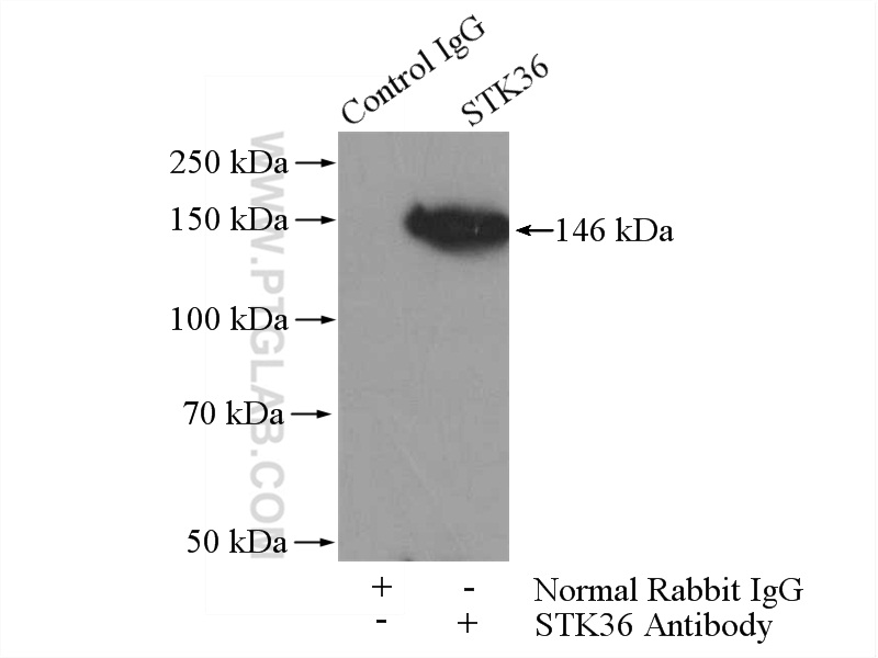 IP experiment of mouse testis using 12559-1-AP