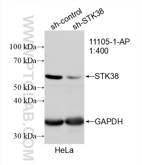 WB analysis of HeLa using 11105-1-AP