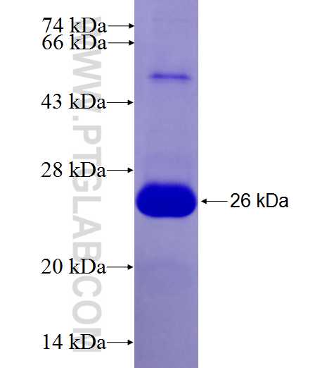 STK38 fusion protein Ag27523 SDS-PAGE