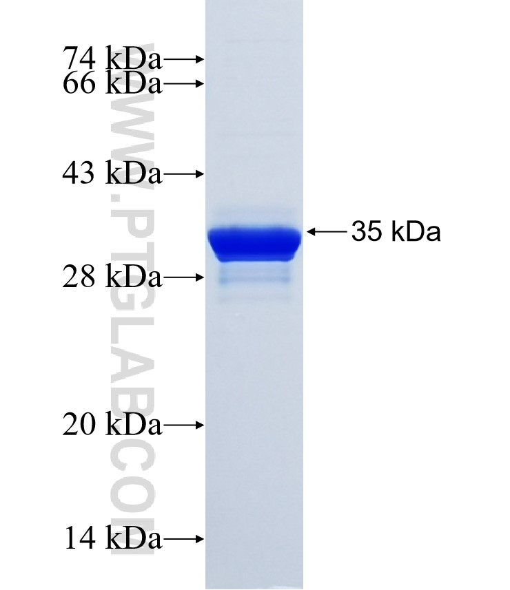 STK39 fusion protein Ag34503 SDS-PAGE
