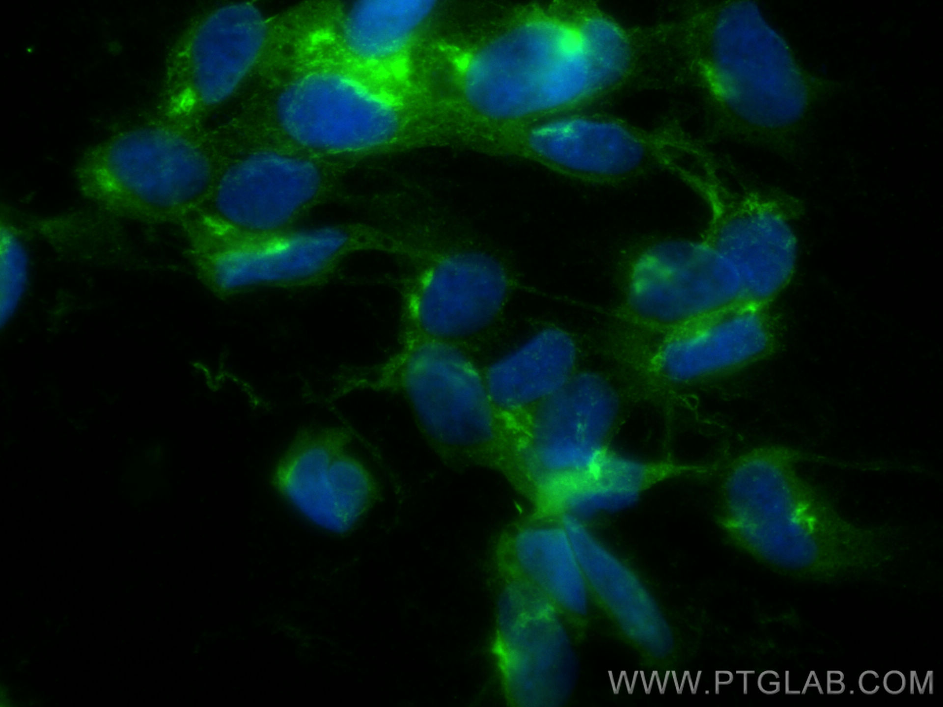 IF Staining of SH-SY5Y using 10586-1-AP