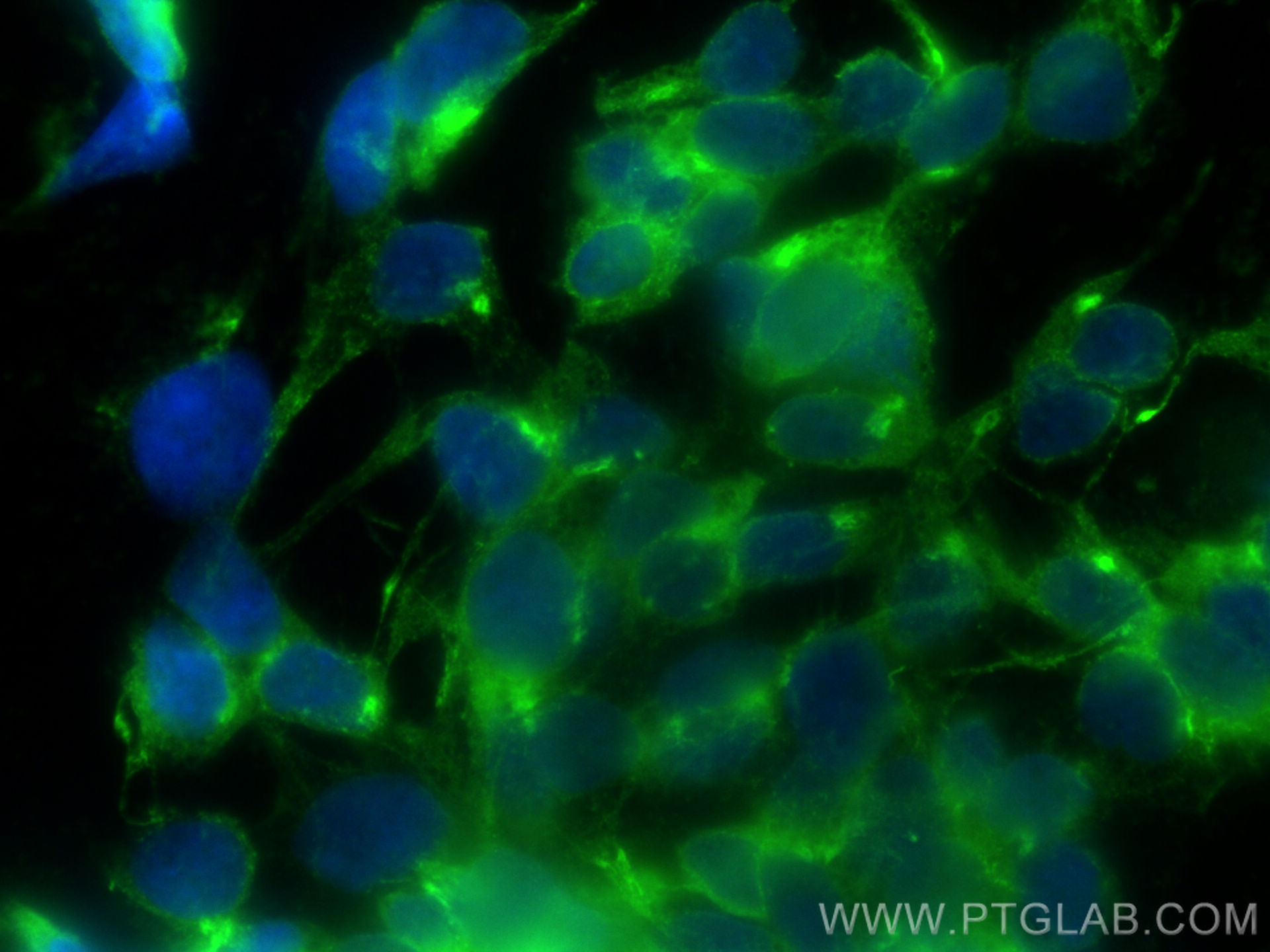 IF Staining of SH-SY5Y using 10586-1-AP