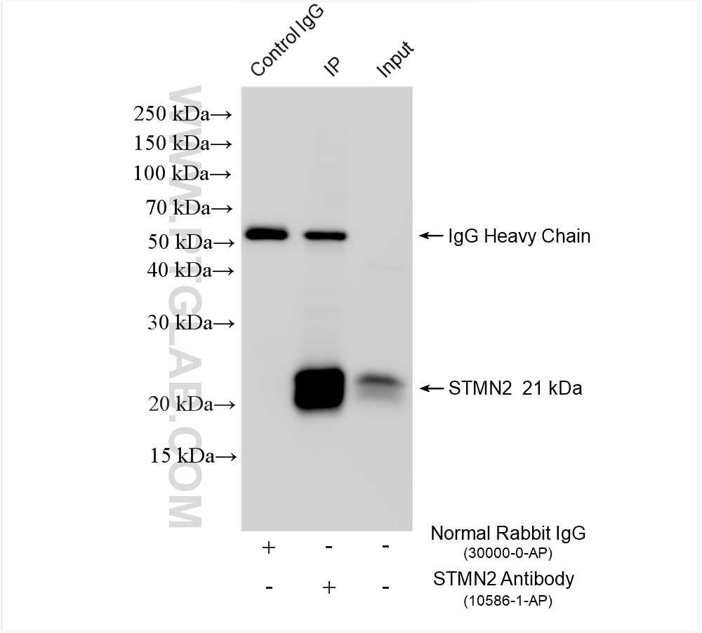 IP experiment of mouse brain using 10586-1-AP