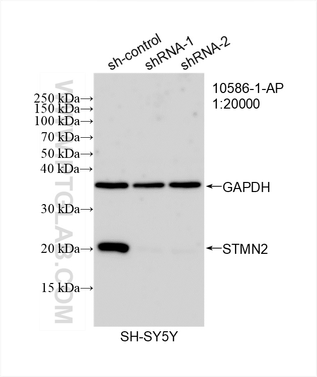 WB analysis of SH-SY5Y using 10586-1-AP