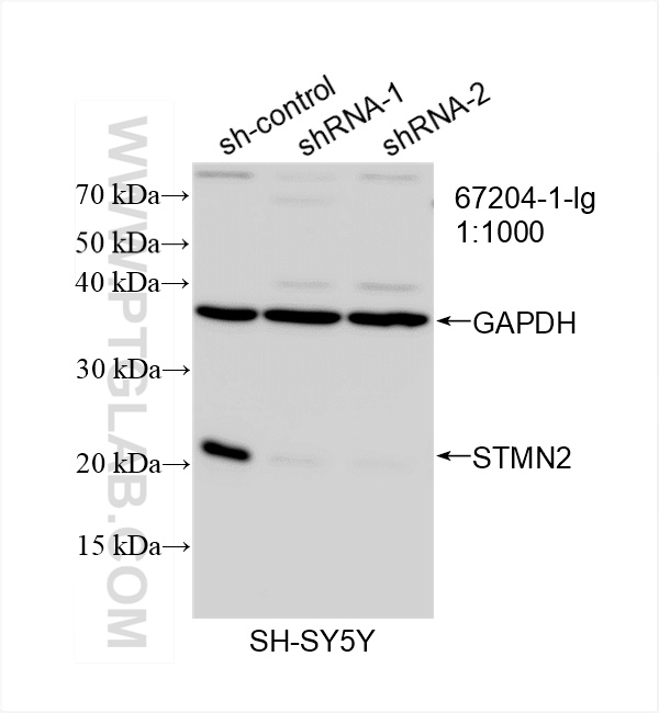 WB analysis of SH-SY5Y using 67204-1-Ig