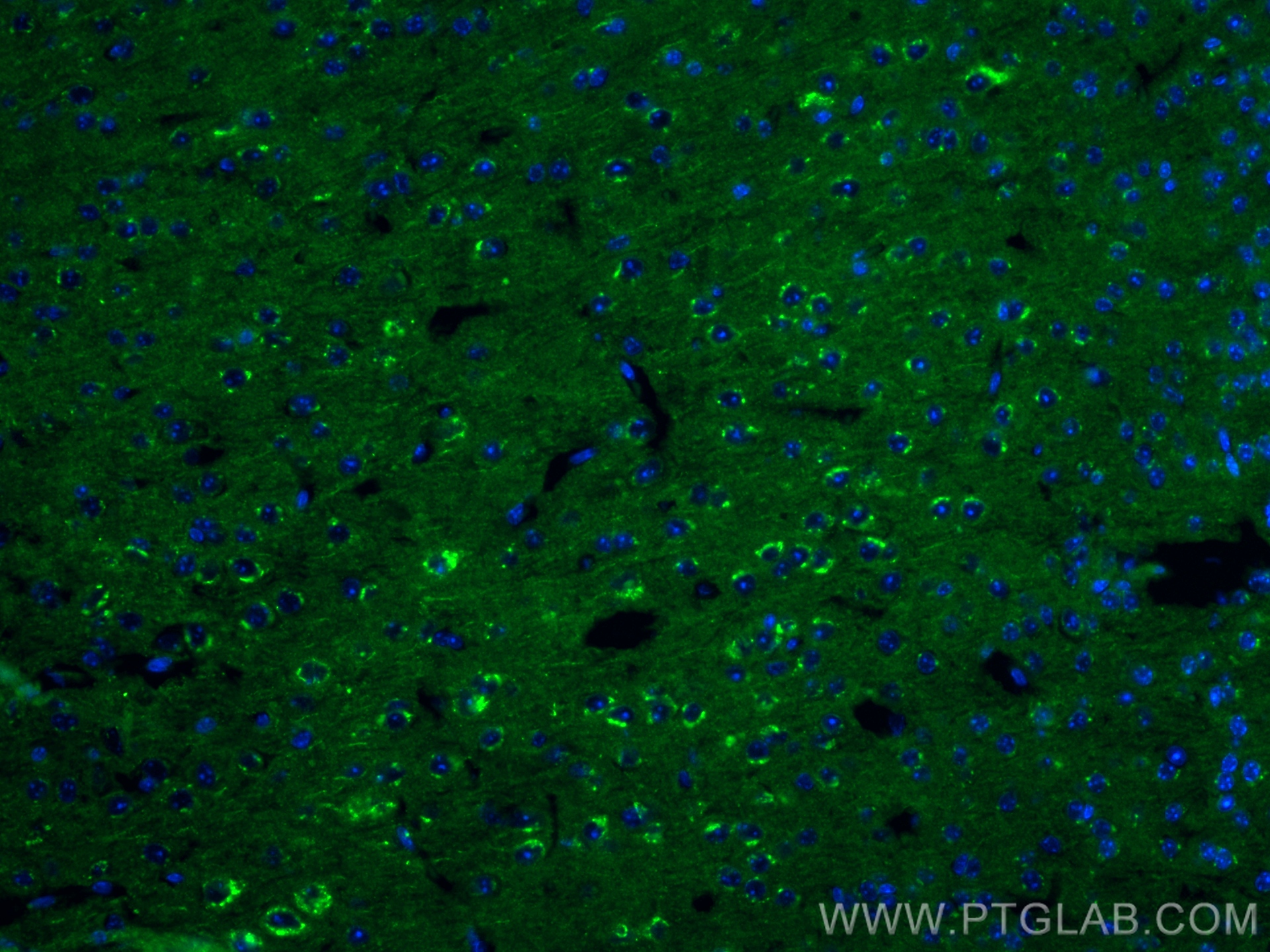 IF Staining of mouse brain using 82925-1-RR